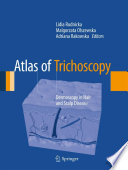 Atlas of Trichoscopy, Dermoscopy in Hair and Scalp Disease